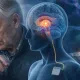 Parkinson Hastalığında Beyin Pili (DBS)